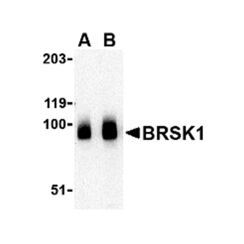 ProSci 4081 BRSK1 Antibody, ProSci, 0.1 mg/Unit Primary Image