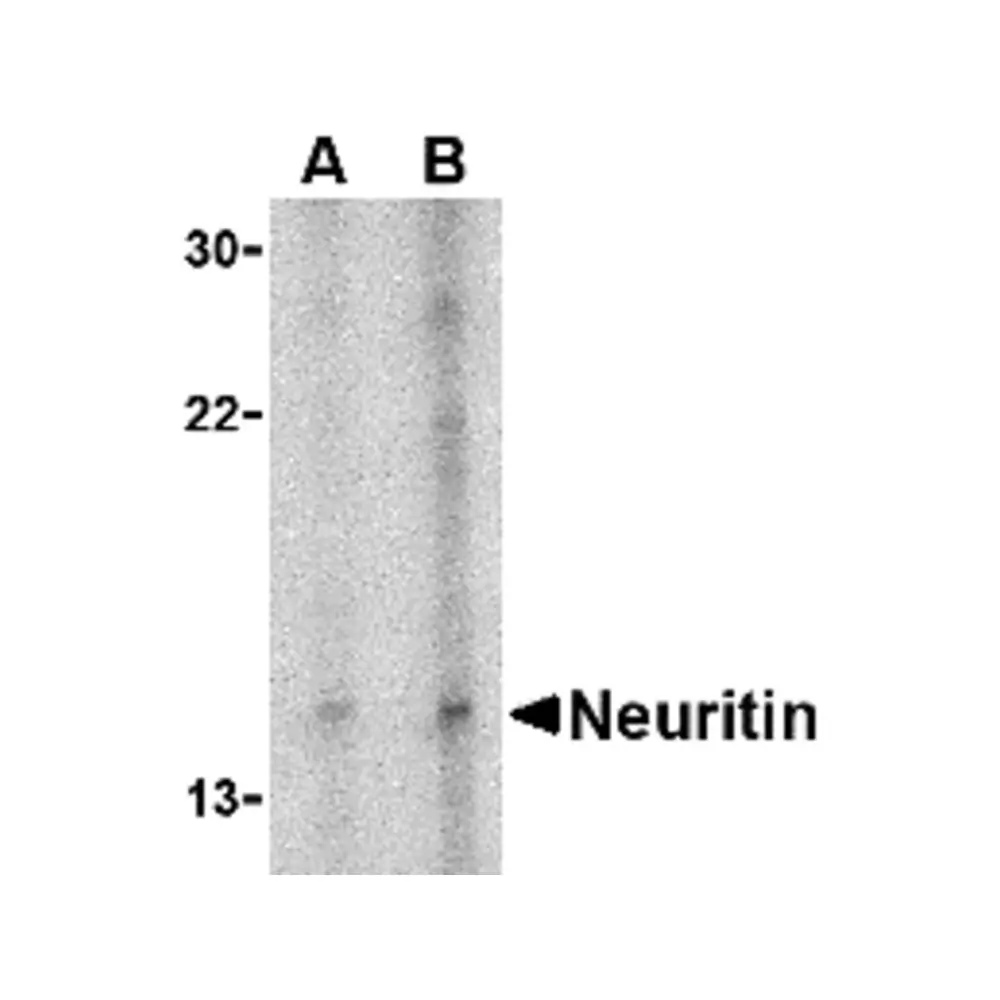 ProSci 4101 Neuritin Antibody, ProSci, 0.1 mg/Unit Primary Image