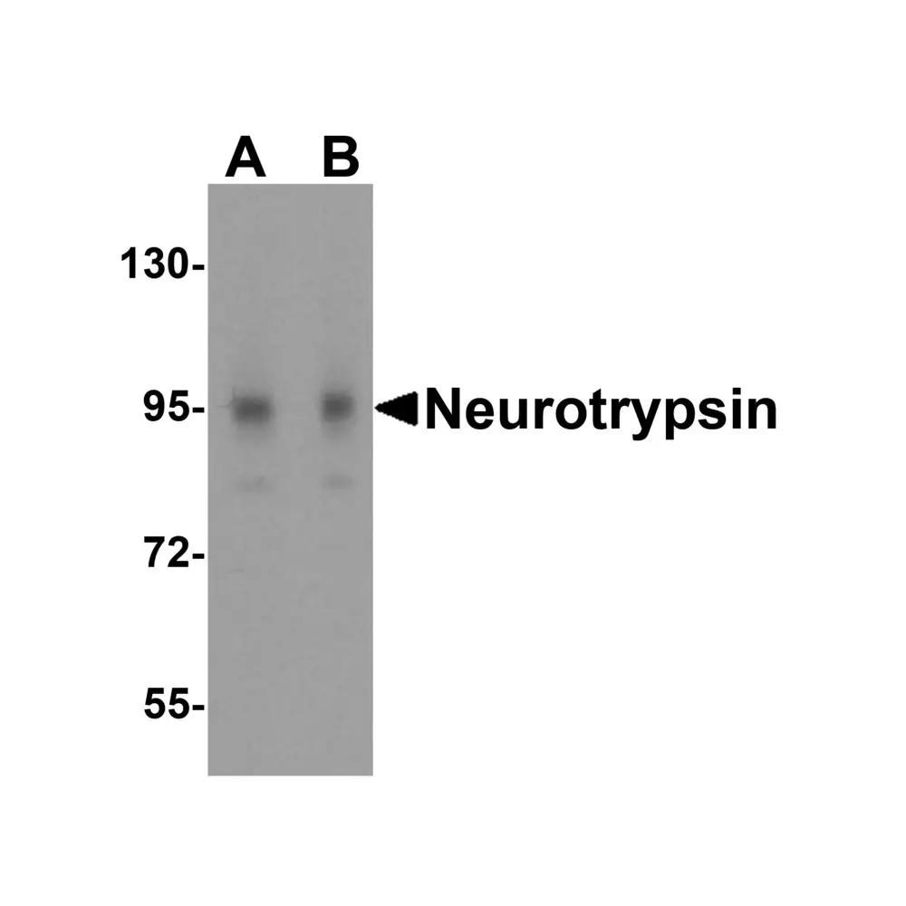 ProSci 4105 Neurotrypsin Antibody, ProSci, 0.1 mg/Unit Primary Image