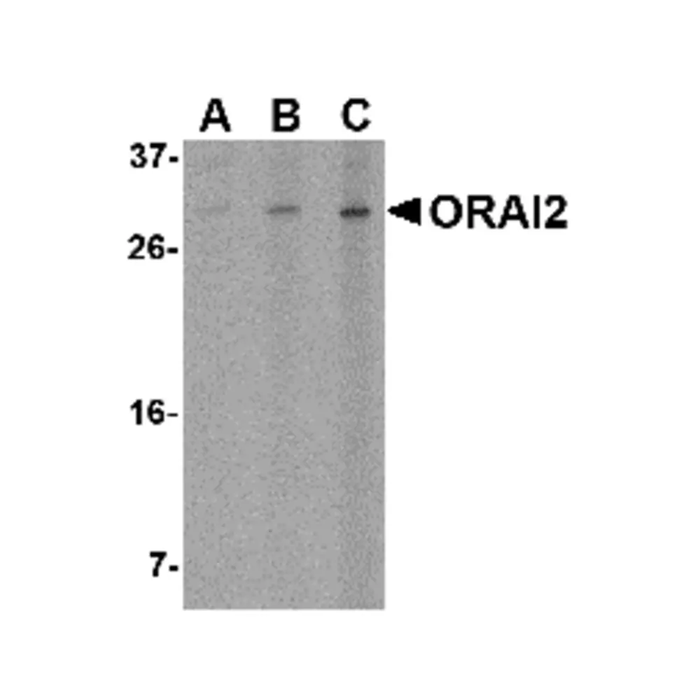 ProSci 4111 ORAI2 Antibody, ProSci, 0.1 mg/Unit Primary Image