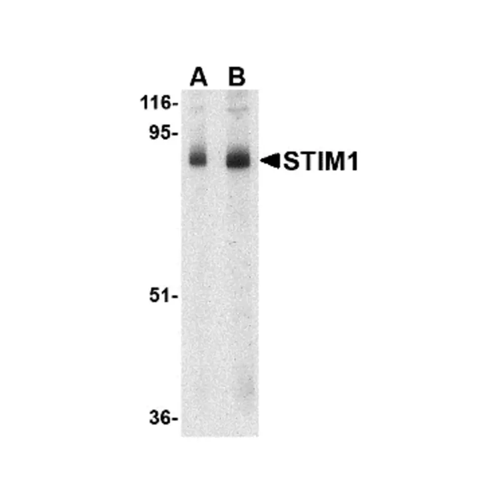 ProSci 4119 STIM1 Antibody, ProSci, 0.1 mg/Unit Primary Image