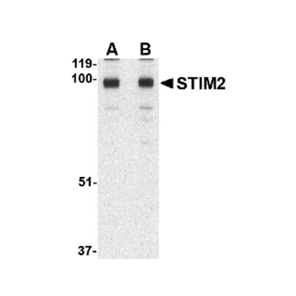ProSci 4123 STIM2 Antibody, ProSci, 0.1 mg/Unit Primary Image