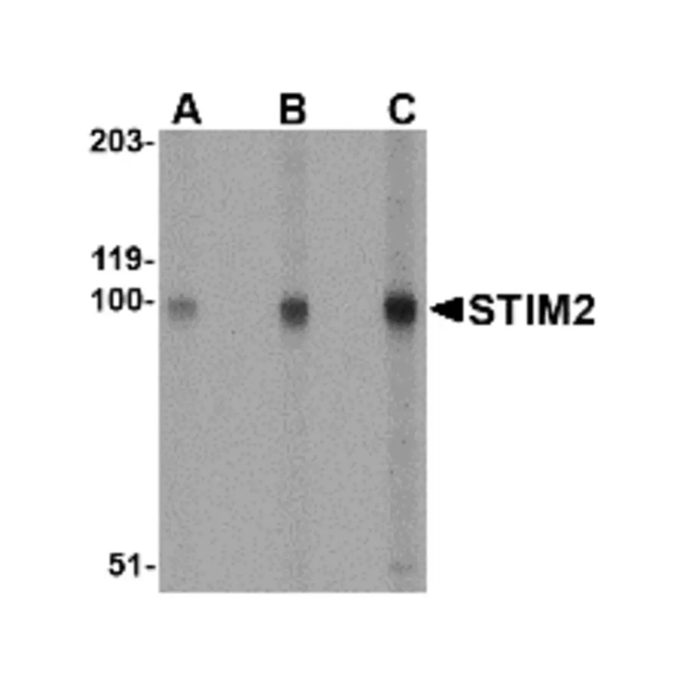 ProSci 4125_S STIM2 Antibody, ProSci, 0.02 mg/Unit Primary Image