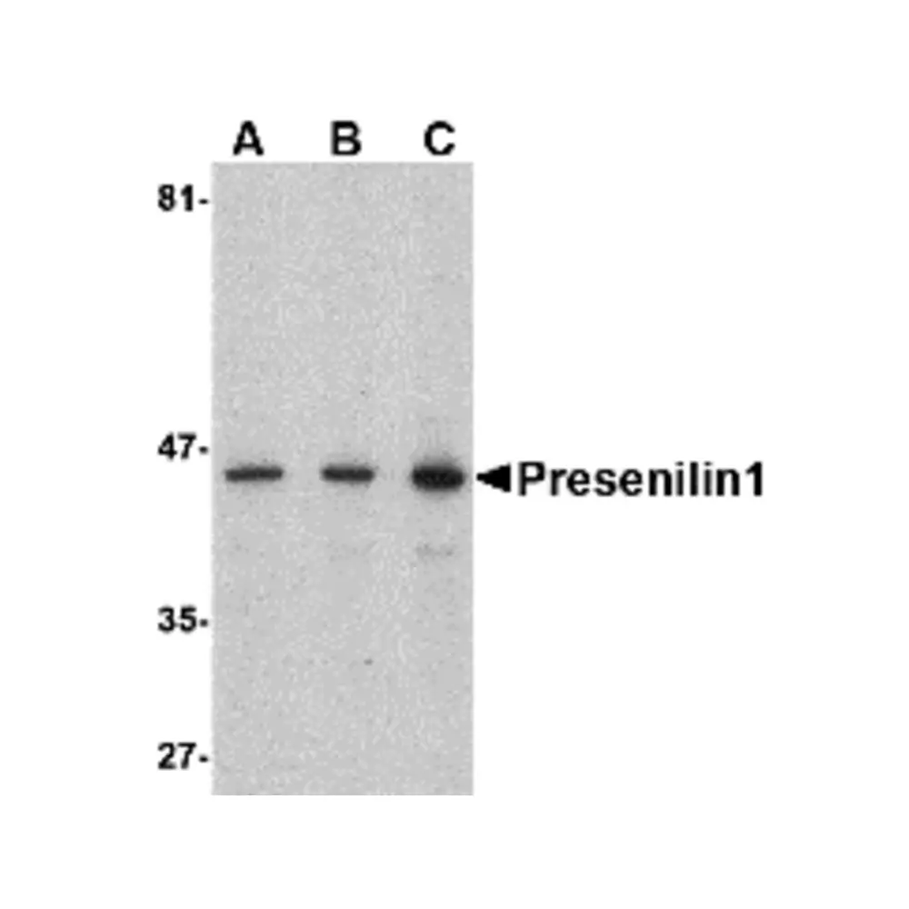 ProSci 4203 Presenilin1 Antibody, ProSci, 0.1 mg/Unit Primary Image