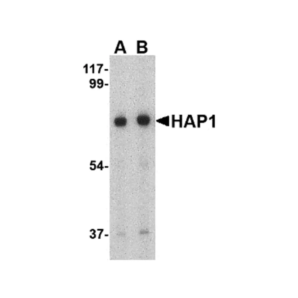 ProSci 4205_S HAP1 Antibody, ProSci, 0.02 mg/Unit Primary Image
