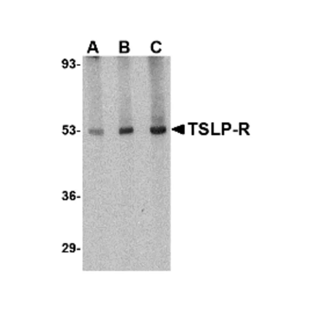 ProSci 4207 TSLP Receptor Antibody, ProSci, 0.1 mg/Unit Primary Image