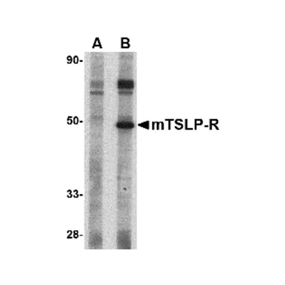 ProSci 4209_S TSLP Receptor Antibody, ProSci, 0.02 mg/Unit Primary Image