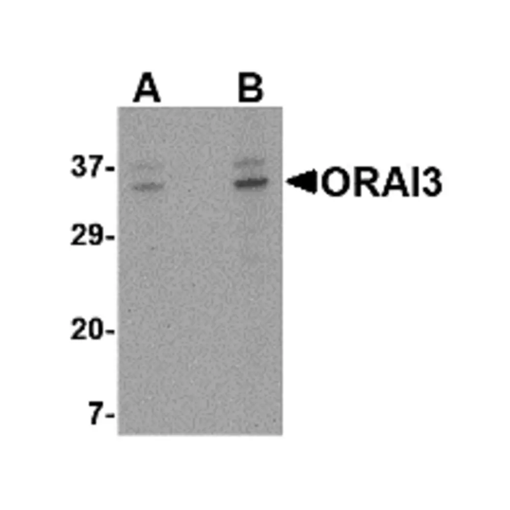 ProSci 4215_S ORAI3 Antibody, ProSci, 0.02 mg/Unit Primary Image