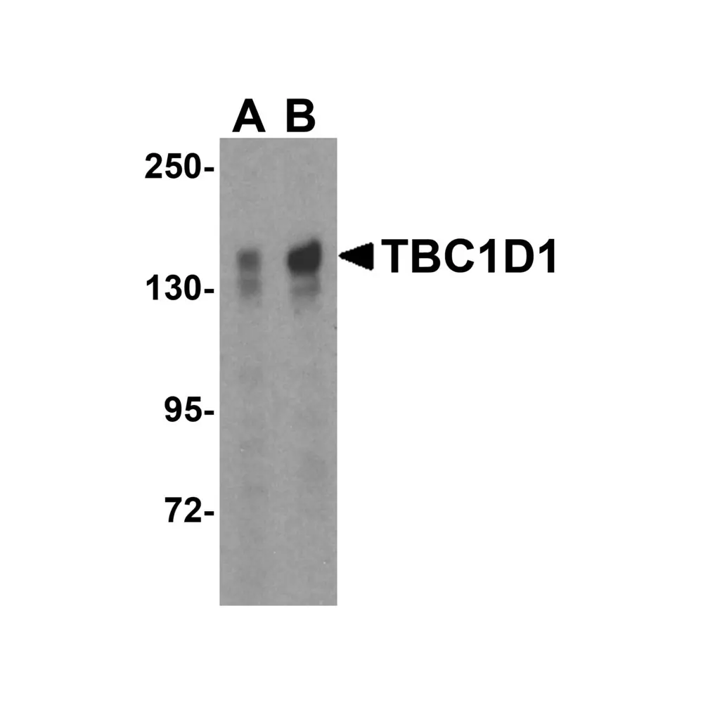 ProSci 4231 TBC1D1 Antibody, ProSci, 0.1 mg/Unit Primary Image