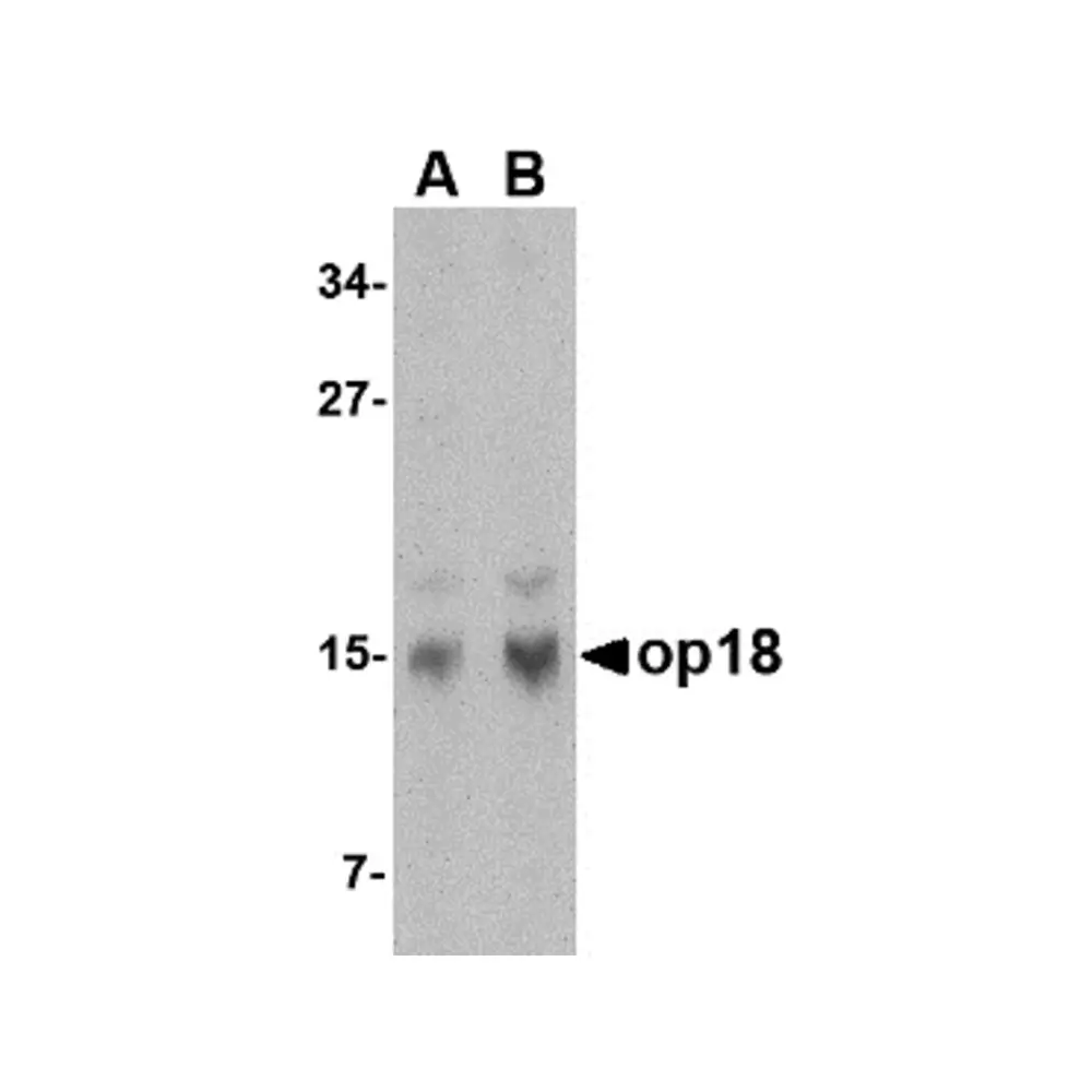 ProSci 4237 op18 Antibody, ProSci, 0.1 mg/Unit Primary Image