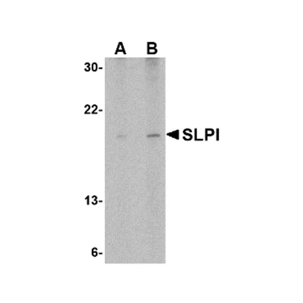 ProSci 4249 SLPI Antibody, ProSci, 0.1 mg/Unit Primary Image
