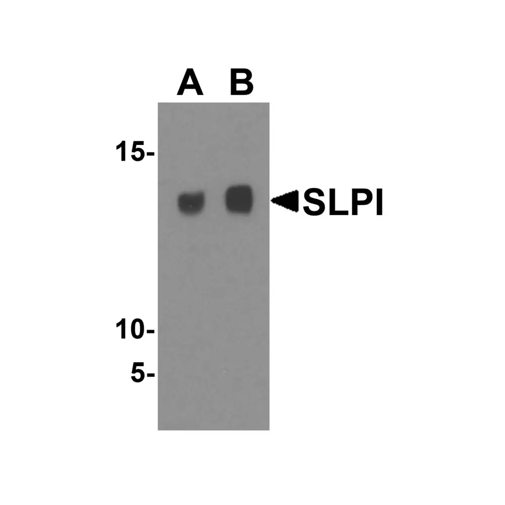 ProSci 4251_S SLPI Antibody, ProSci, 0.02 mg/Unit Primary Image