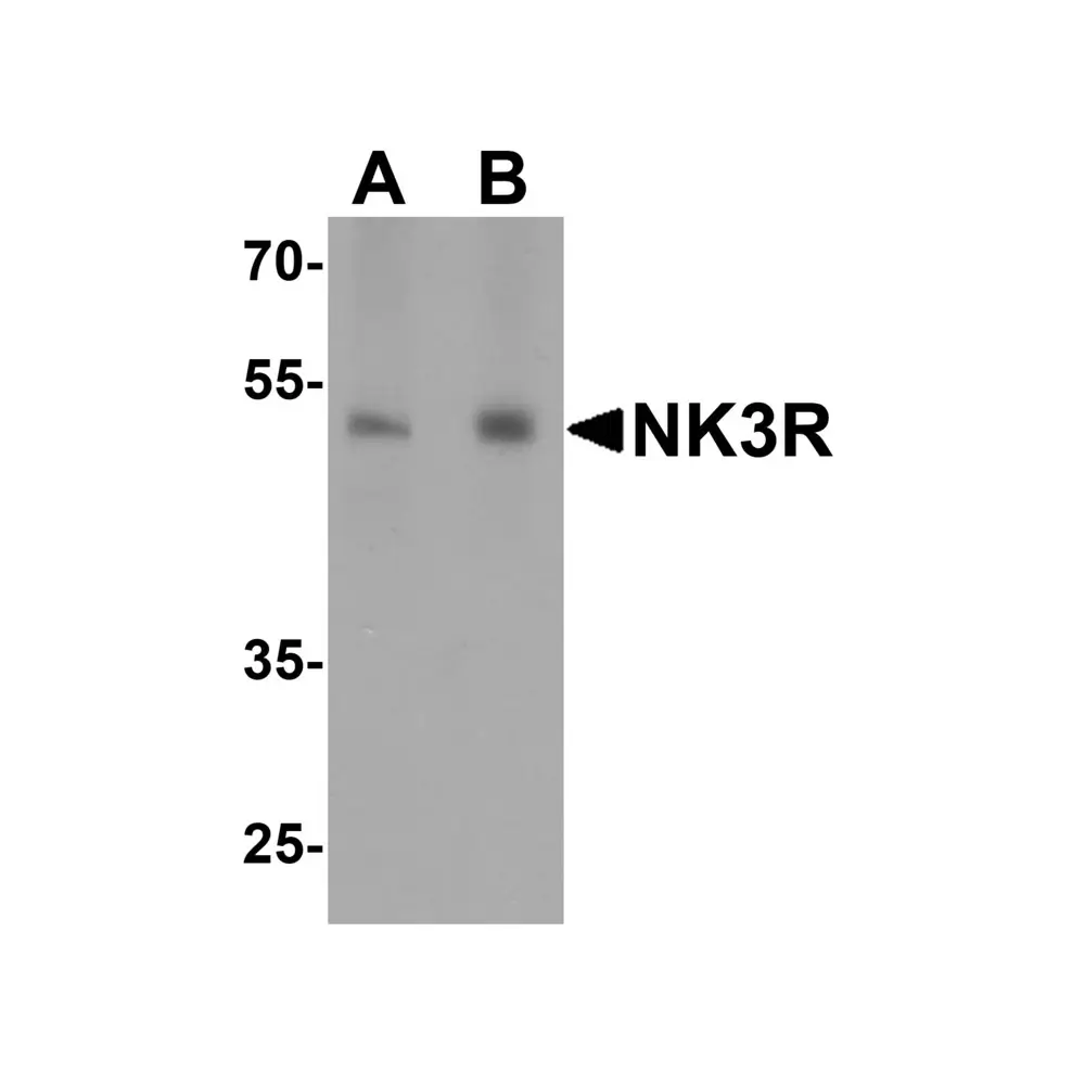 ProSci 4255 NK3R Antibody, ProSci, 0.1 mg/Unit Primary Image