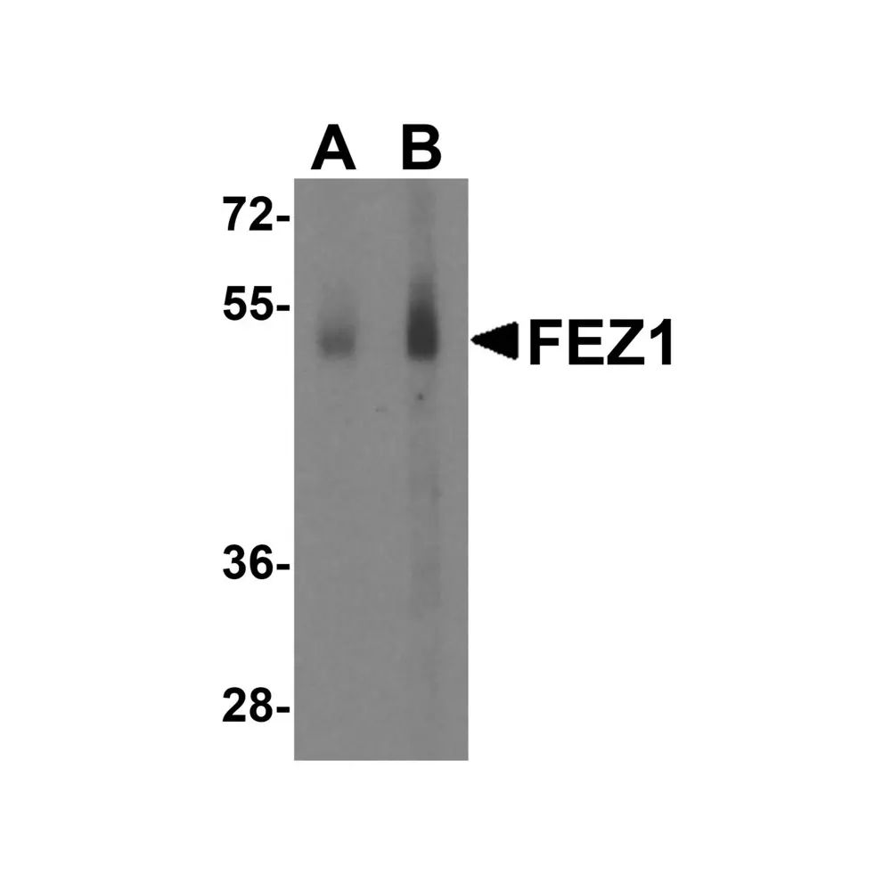 ProSci 4265 FEZ1 Antibody, ProSci, 0.1 mg/Unit Primary Image