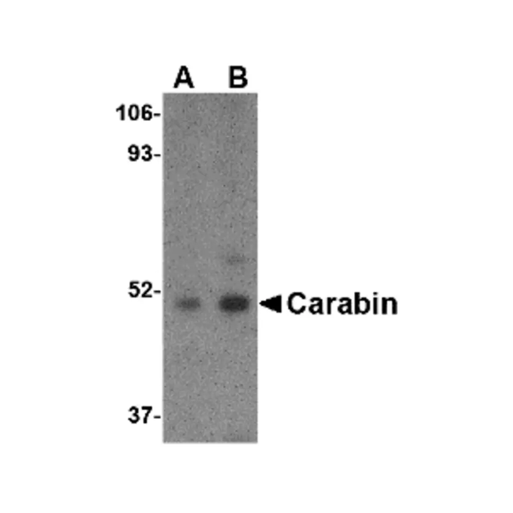 ProSci 4267_S Carabin Antibody, ProSci, 0.02 mg/Unit Primary Image