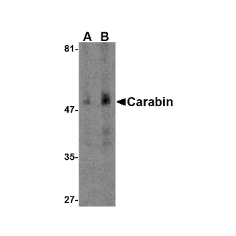 ProSci 4269_S Carabin Antibody, ProSci, 0.02 mg/Unit Primary Image