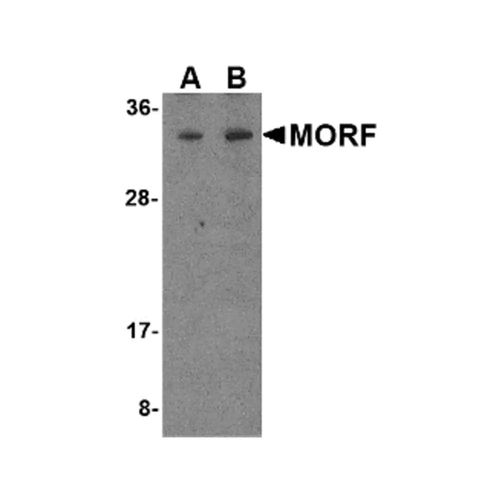 ProSci 4275 MORF4 Antibody, ProSci, 0.1 mg/Unit Primary Image