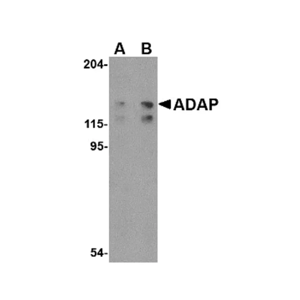 ProSci 4277 ADAP Antibody, ProSci, 0.1 mg/Unit Primary Image