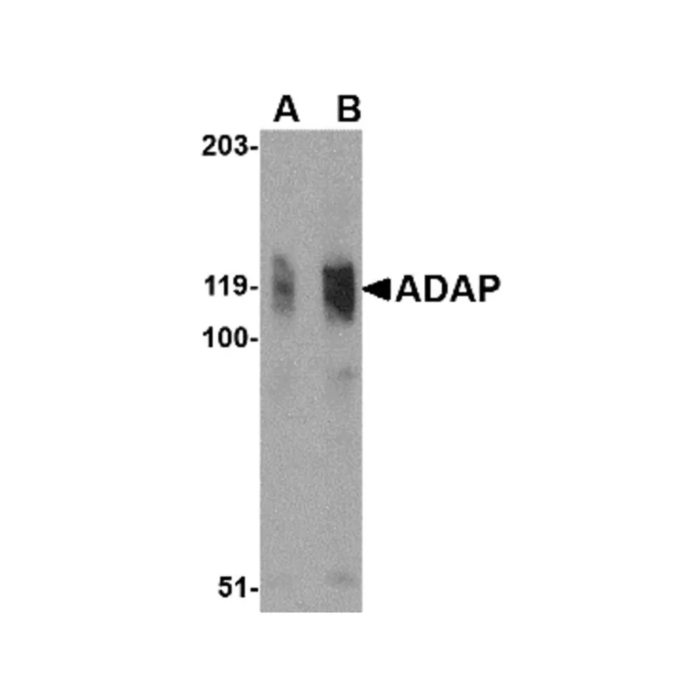 ProSci 4279_S ADAP Antibody, ProSci, 0.02 mg/Unit Primary Image