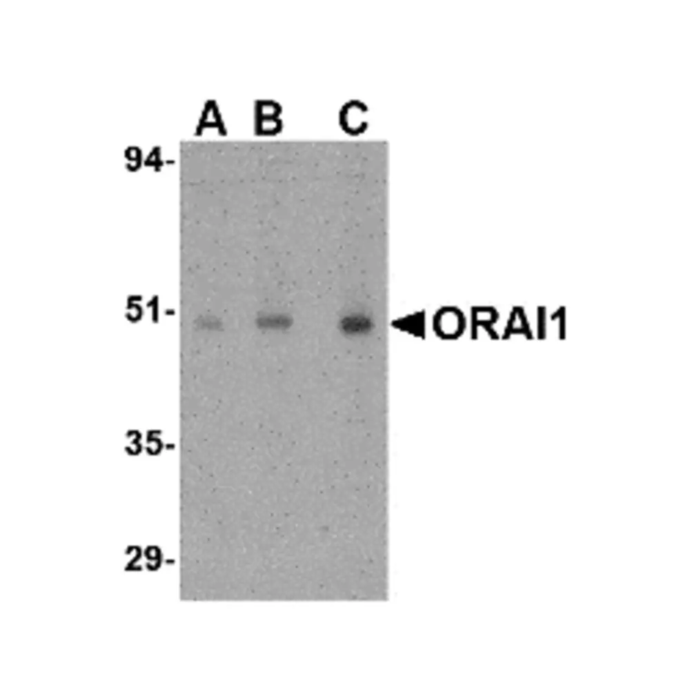 ProSci 4281_S ORAI1 Antibody, ProSci, 0.02 mg/Unit Primary Image