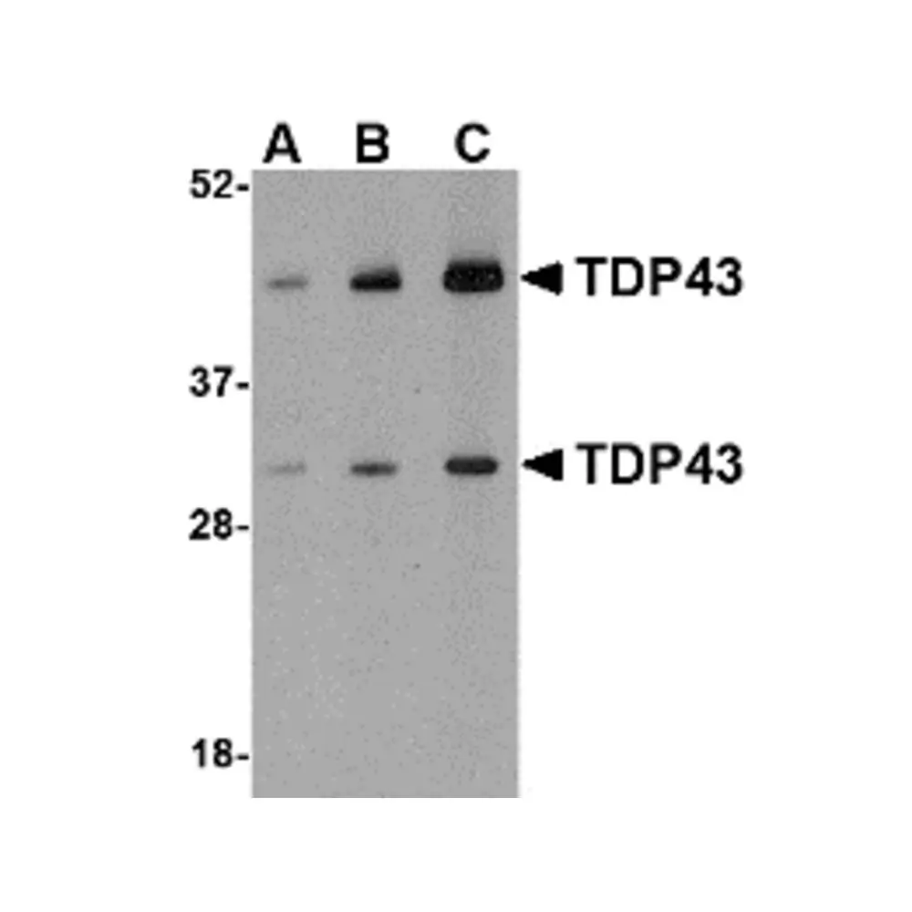ProSci 4283 TDP43 Antibody, ProSci, 0.1 mg/Unit Primary Image