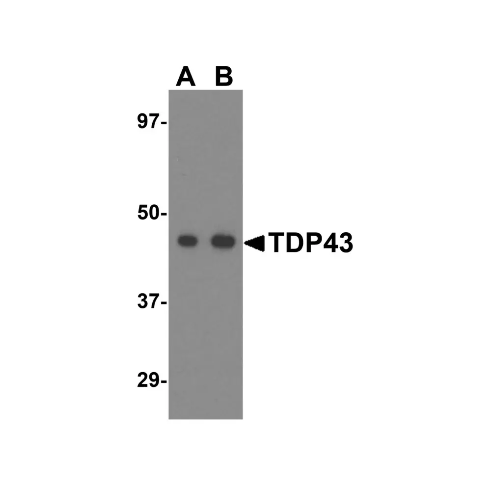 ProSci 4285_S TDP43 Antibody, ProSci, 0.02 mg/Unit Primary Image