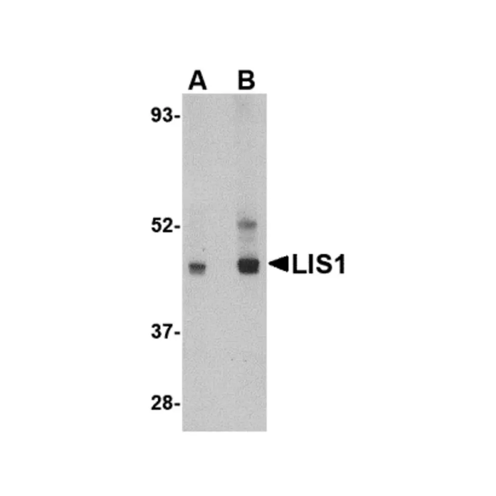 ProSci 4287 LIS1 Antibody, ProSci, 0.1 mg/Unit Primary Image
