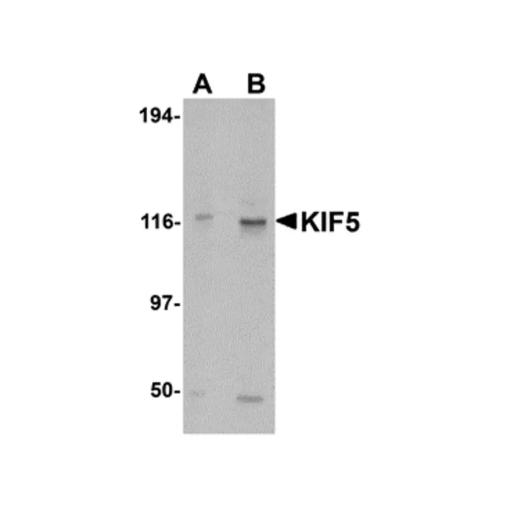 ProSci 4289_S KIF5 Antibody, ProSci, 0.02 mg/Unit Primary Image