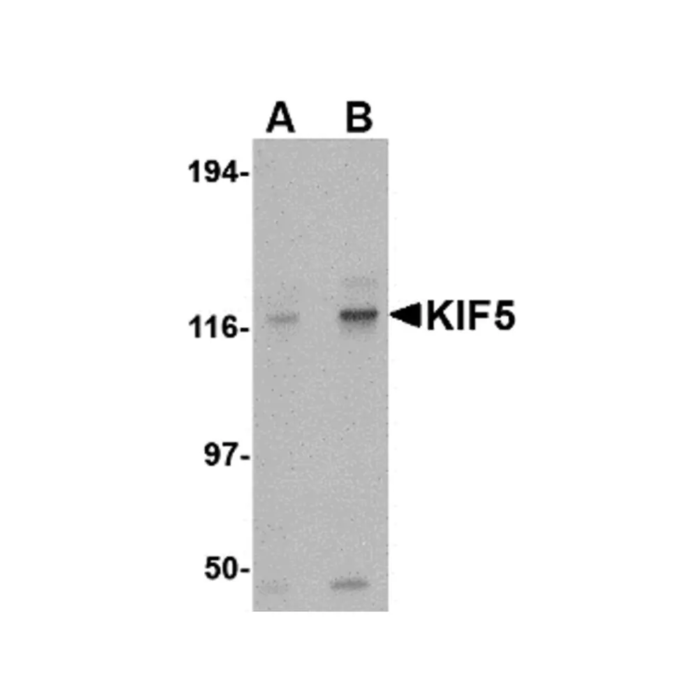 ProSci 4291_S KIF5 Antibody, ProSci, 0.02 mg/Unit Primary Image