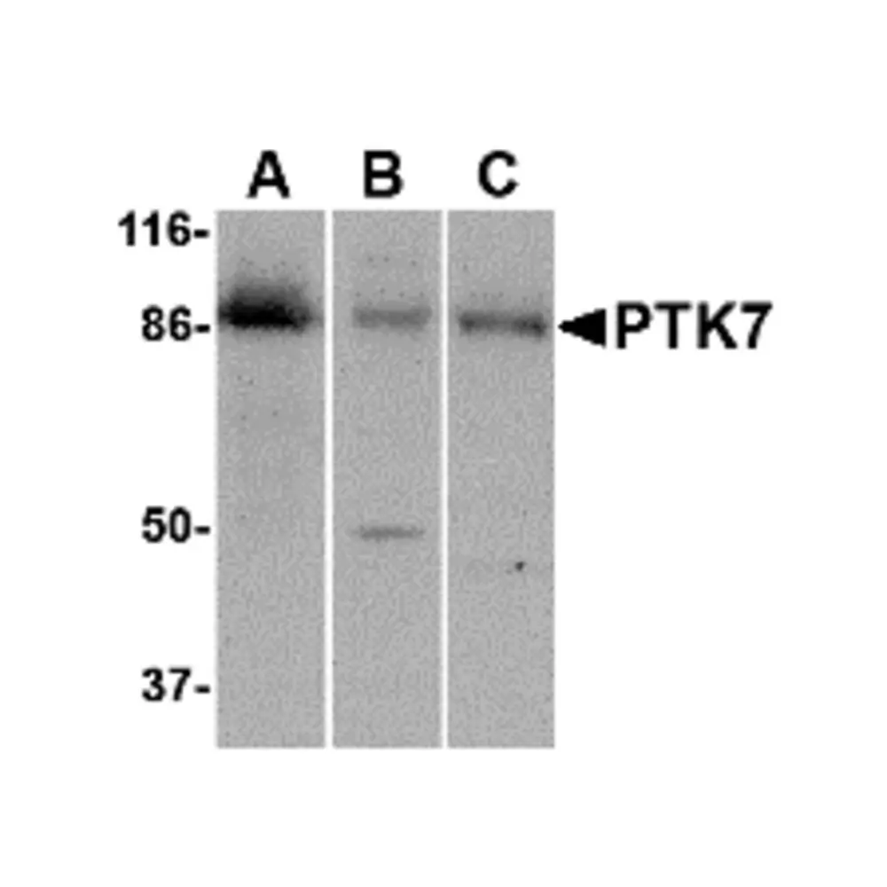 ProSci 4297_S PTK7 Antibody, ProSci, 0.02 mg/Unit Primary Image