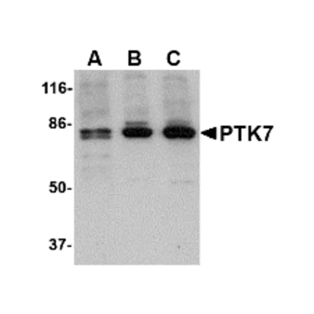ProSci 4299_S PTK7 Antibody, ProSci, 0.02 mg/Unit Primary Image