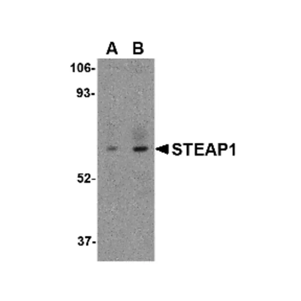 ProSci 4303_S STEAP1 Antibody, ProSci, 0.02 mg/Unit Primary Image