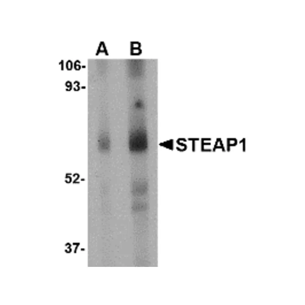 ProSci 4305 STEAP1 Antibody, ProSci, 0.1 mg/Unit Primary Image