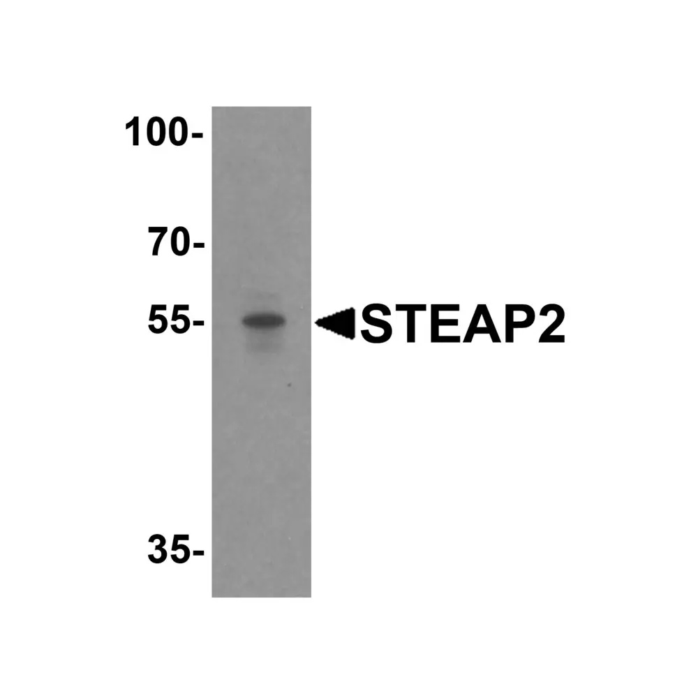 ProSci 4307_S STEAP2 Antibody, ProSci, 0.02 mg/Unit Primary Image