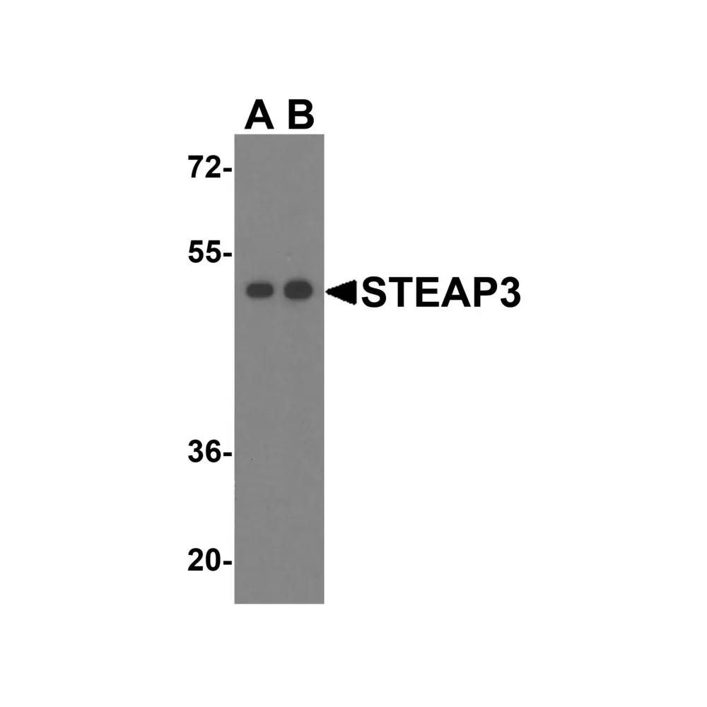 ProSci 4311 STEAP3 Antibody, ProSci, 0.1 mg/Unit Primary Image