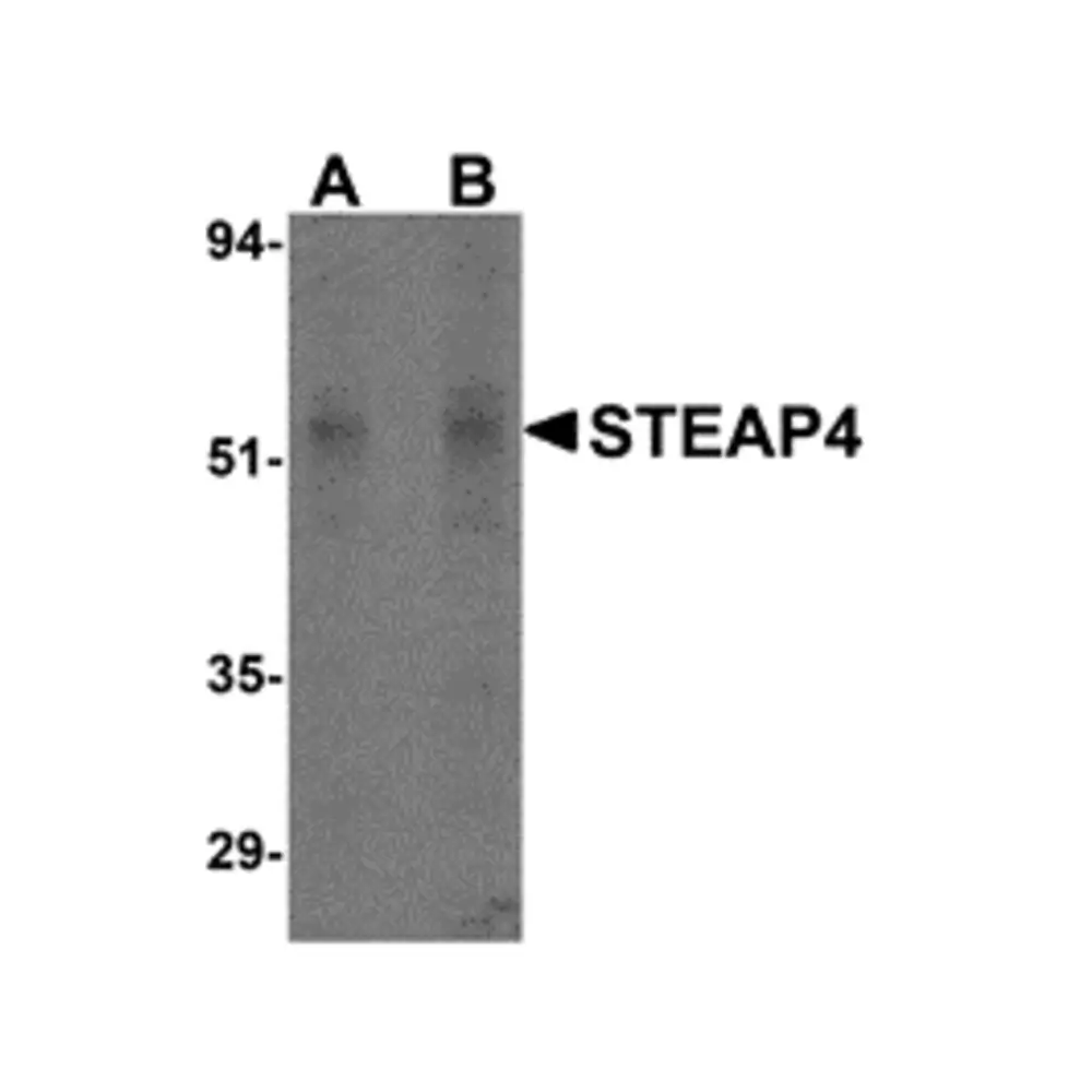 ProSci 4313_S STEAP4 Antibody, ProSci, 0.02 mg/Unit Primary Image