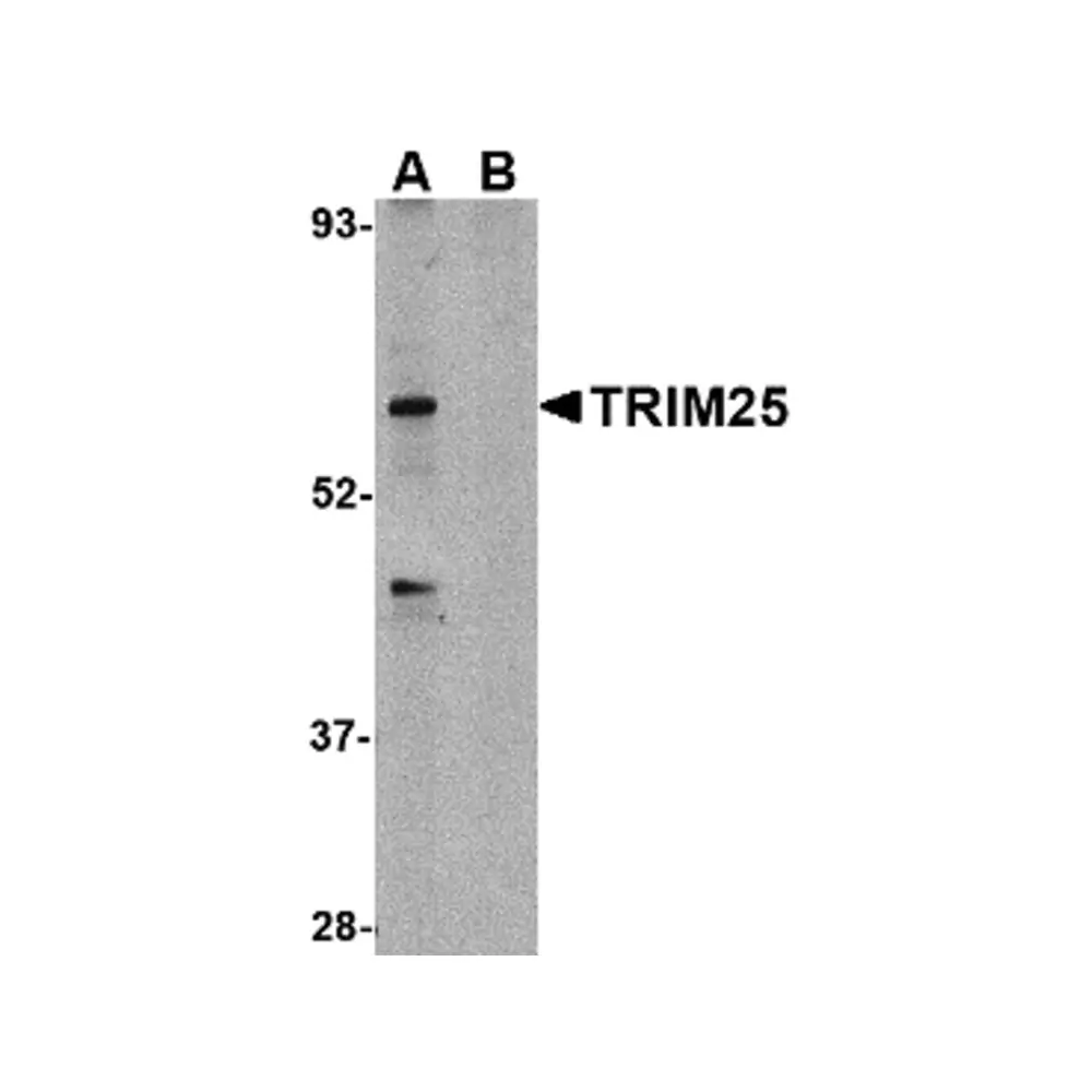 ProSci 4315_S TRIM25 Antibody, ProSci, 0.02 mg/Unit Primary Image