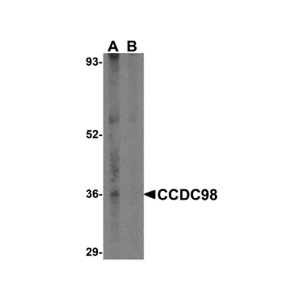 ProSci 4321 CCDC98 Antibody, ProSci, 0.1 mg/Unit Primary Image