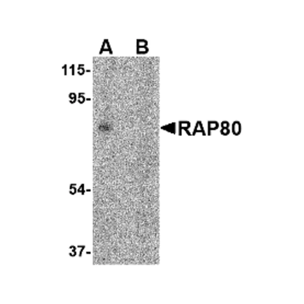 ProSci 4325 RAP80 Antibody, ProSci, 0.1 mg/Unit Primary Image