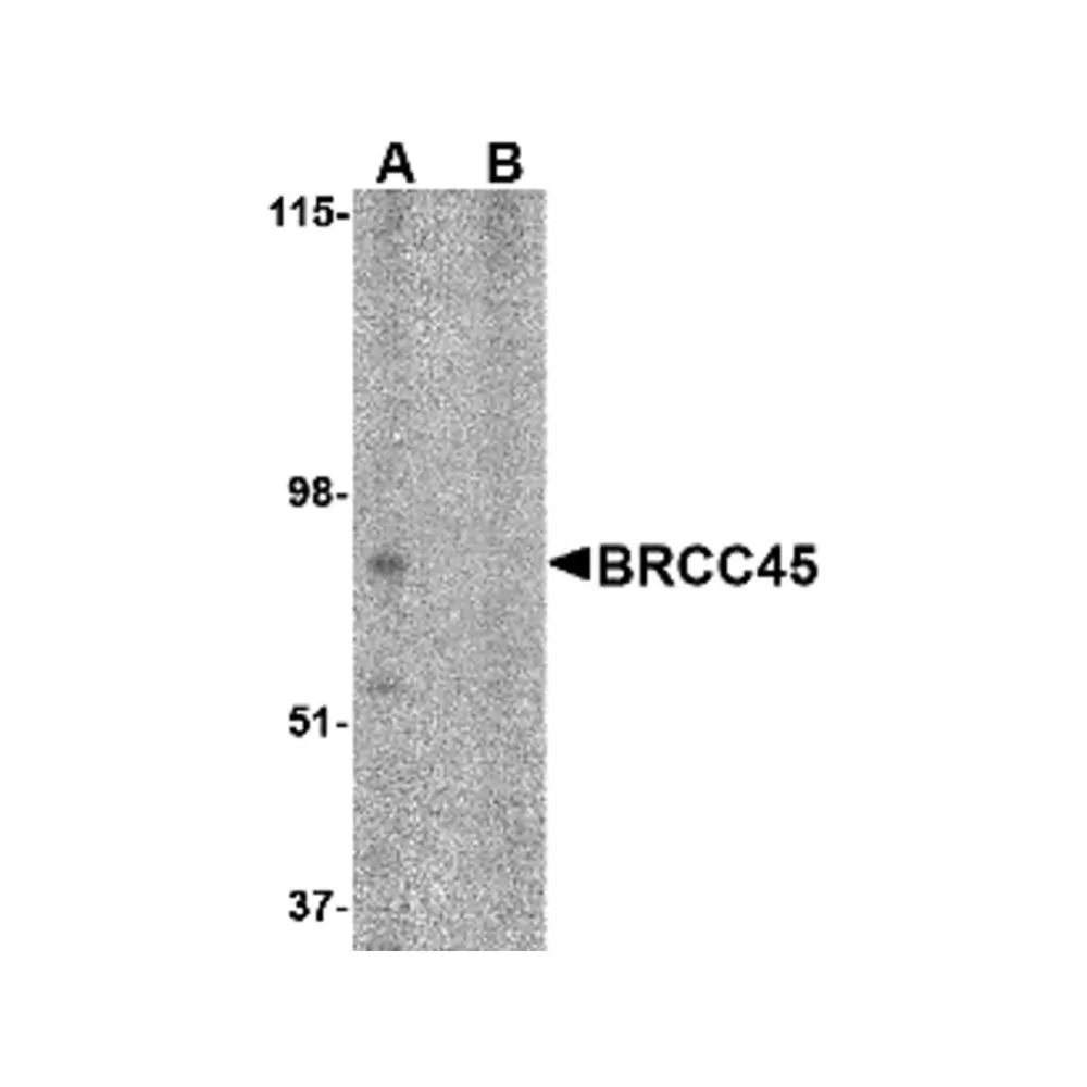 ProSci 4329_S BRCC45 Antibody, ProSci, 0.02 mg/Unit Primary Image