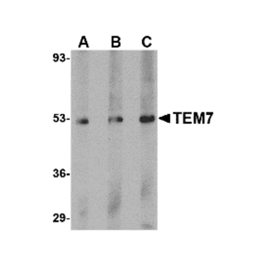 ProSci 4339 TEM7 Antibody, ProSci, 0.1 mg/Unit Primary Image