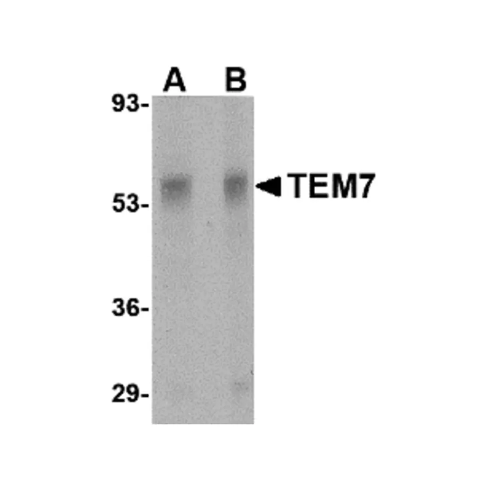 ProSci 4341 TEM7 Antibody, ProSci, 0.1 mg/Unit Primary Image