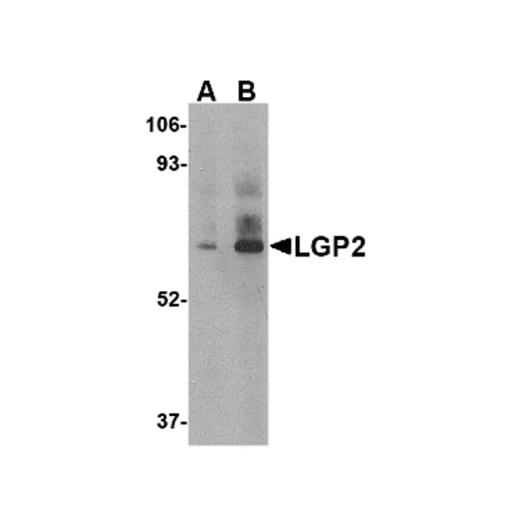 ProSci 4351 LGP2 Antibody, ProSci, 0.1 mg/Unit Primary Image
