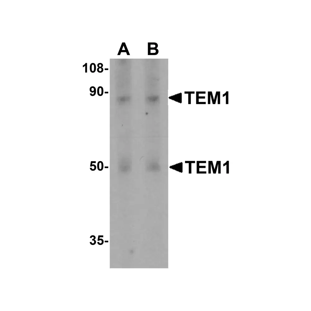 ProSci 4357_S TEM1 Antibody, ProSci, 0.02 mg/Unit Primary Image