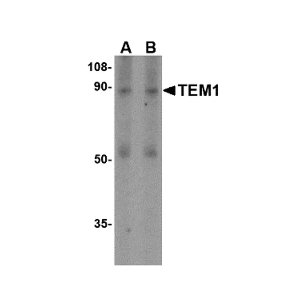 ProSci 4359_S TEM1 Antibody, ProSci, 0.02 mg/Unit Primary Image