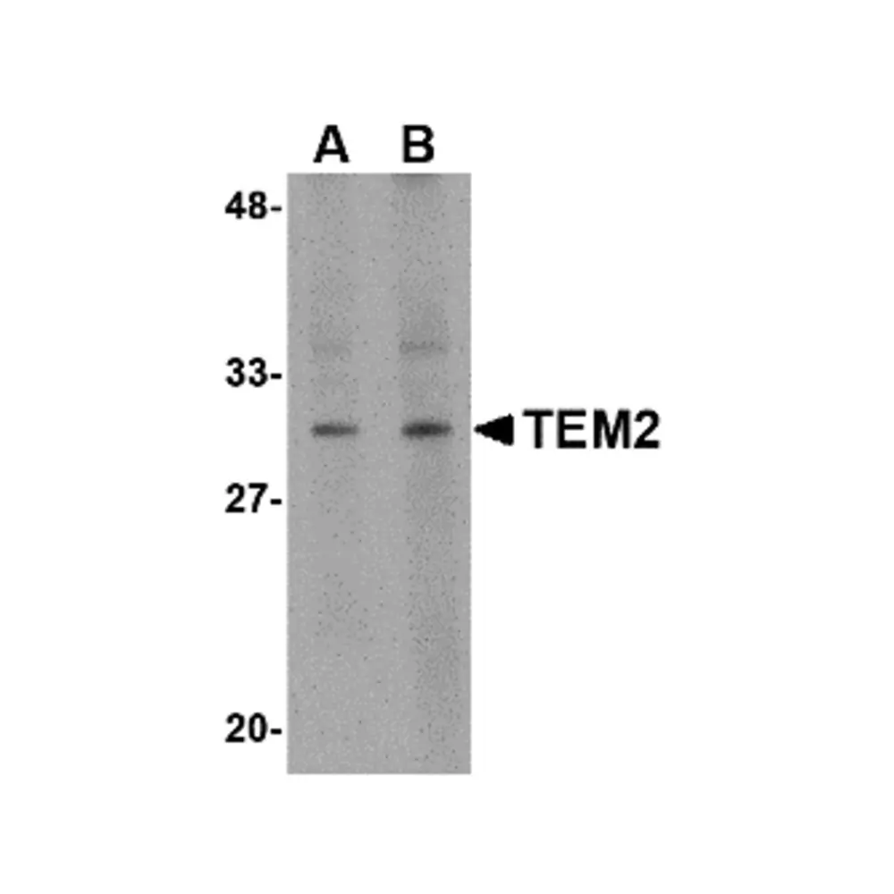 ProSci 4361 TEM2 Antibody, ProSci, 0.1 mg/Unit Primary Image