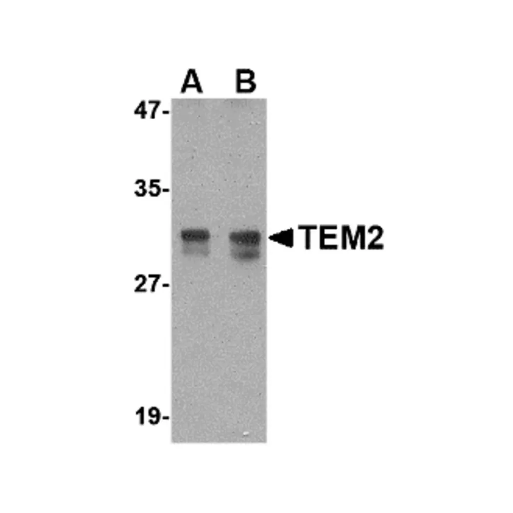 ProSci 4363_S TEM2 Antibody, ProSci, 0.02 mg/Unit Primary Image