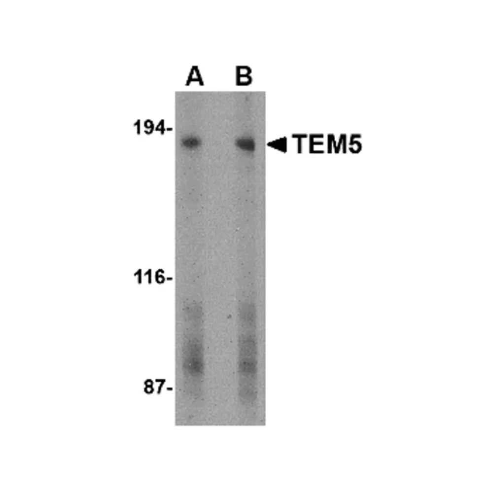 ProSci 4369 TEM5 Antibody, ProSci, 0.1 mg/Unit Primary Image