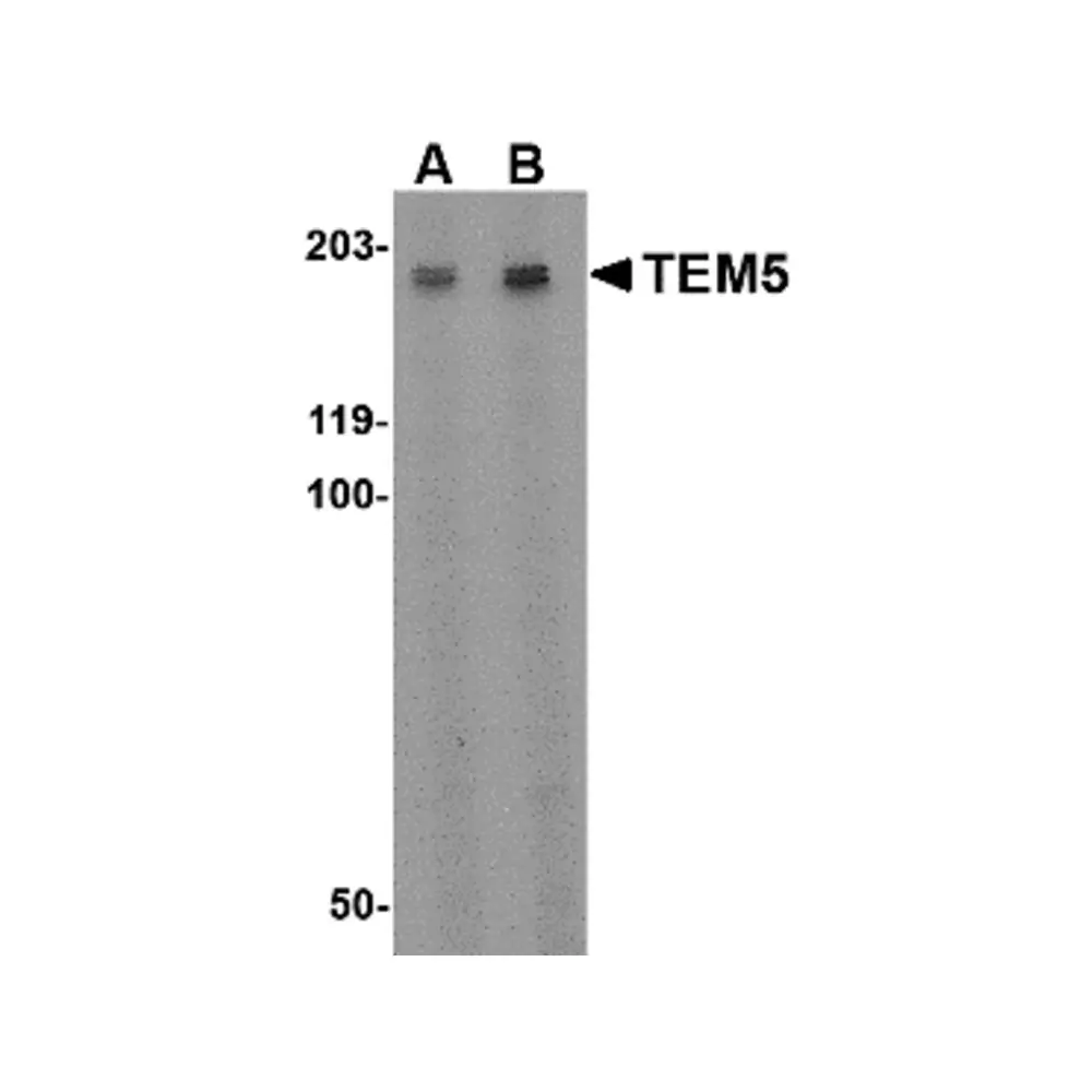 ProSci 4371 TEM5 Antibody, ProSci, 0.1 mg/Unit Primary Image