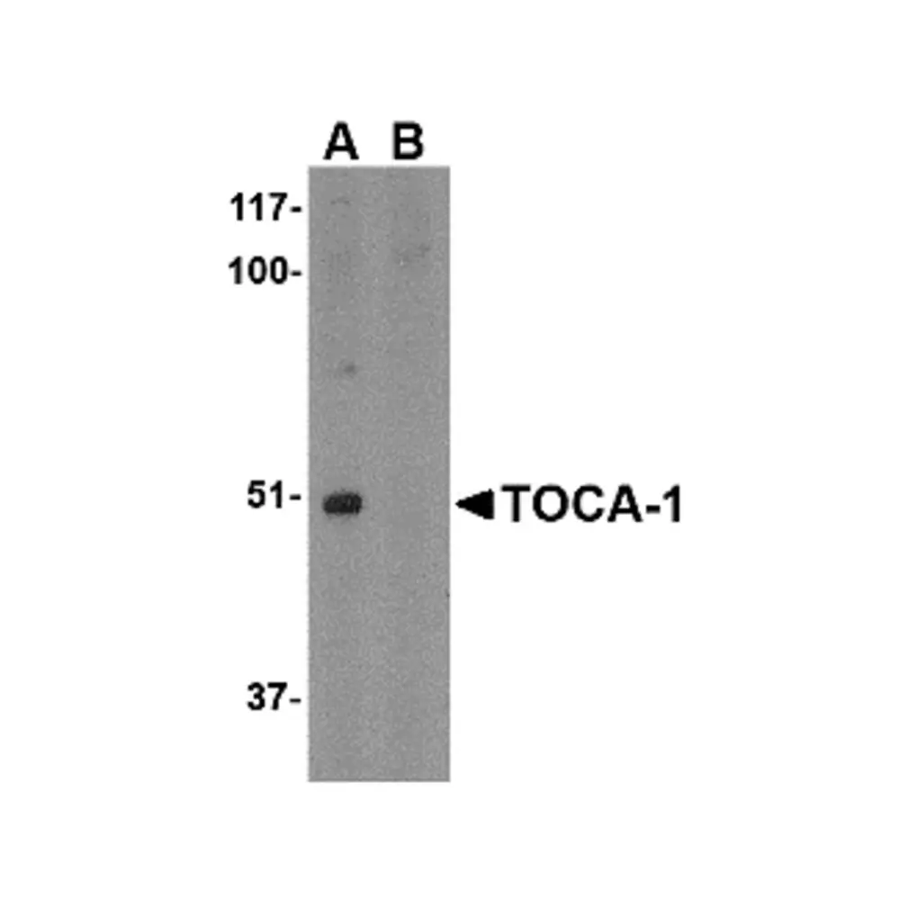 ProSci 4373 TOCA-1 Antibody, ProSci, 0.1 mg/Unit Primary Image